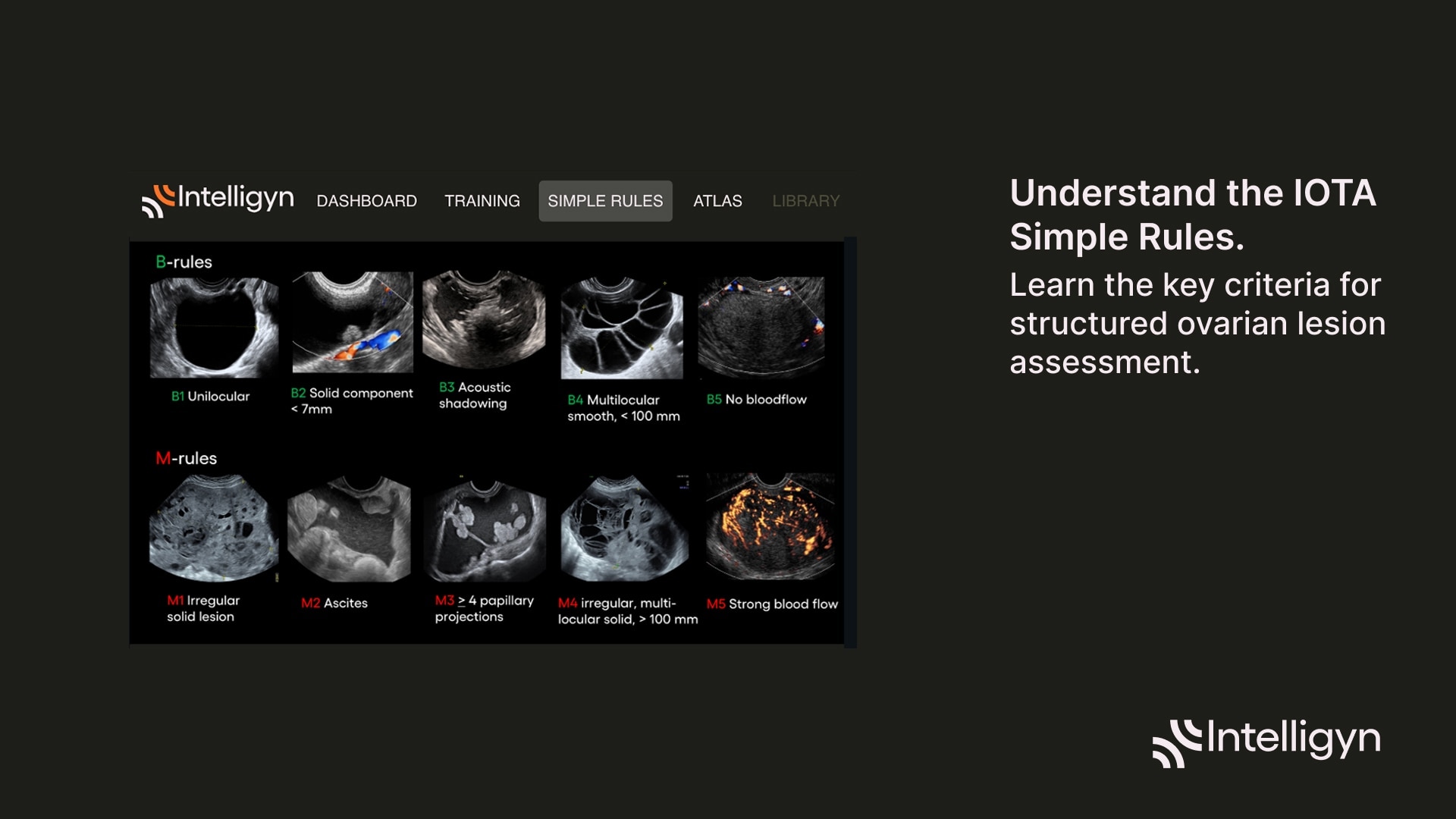 Product Media Carousel Image