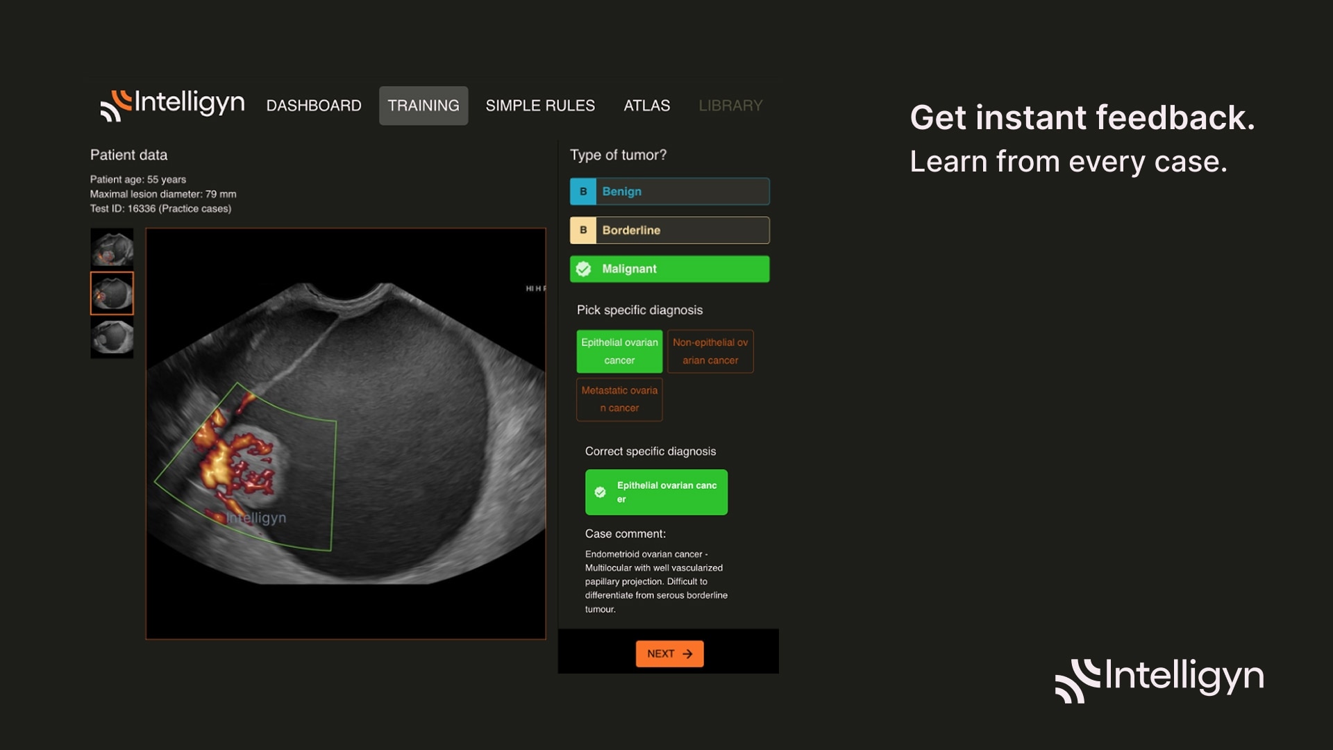 Product Media Carousel Image