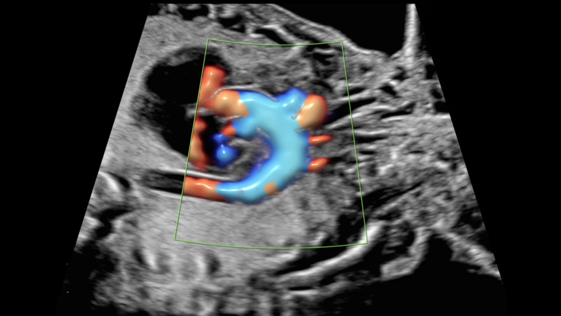 Product Media Carousel Image