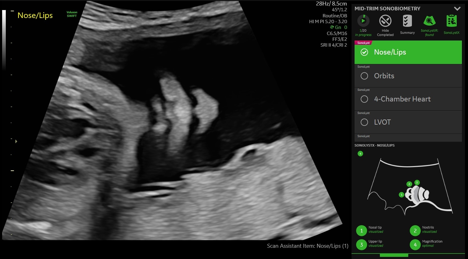 Product Media Carousel Image