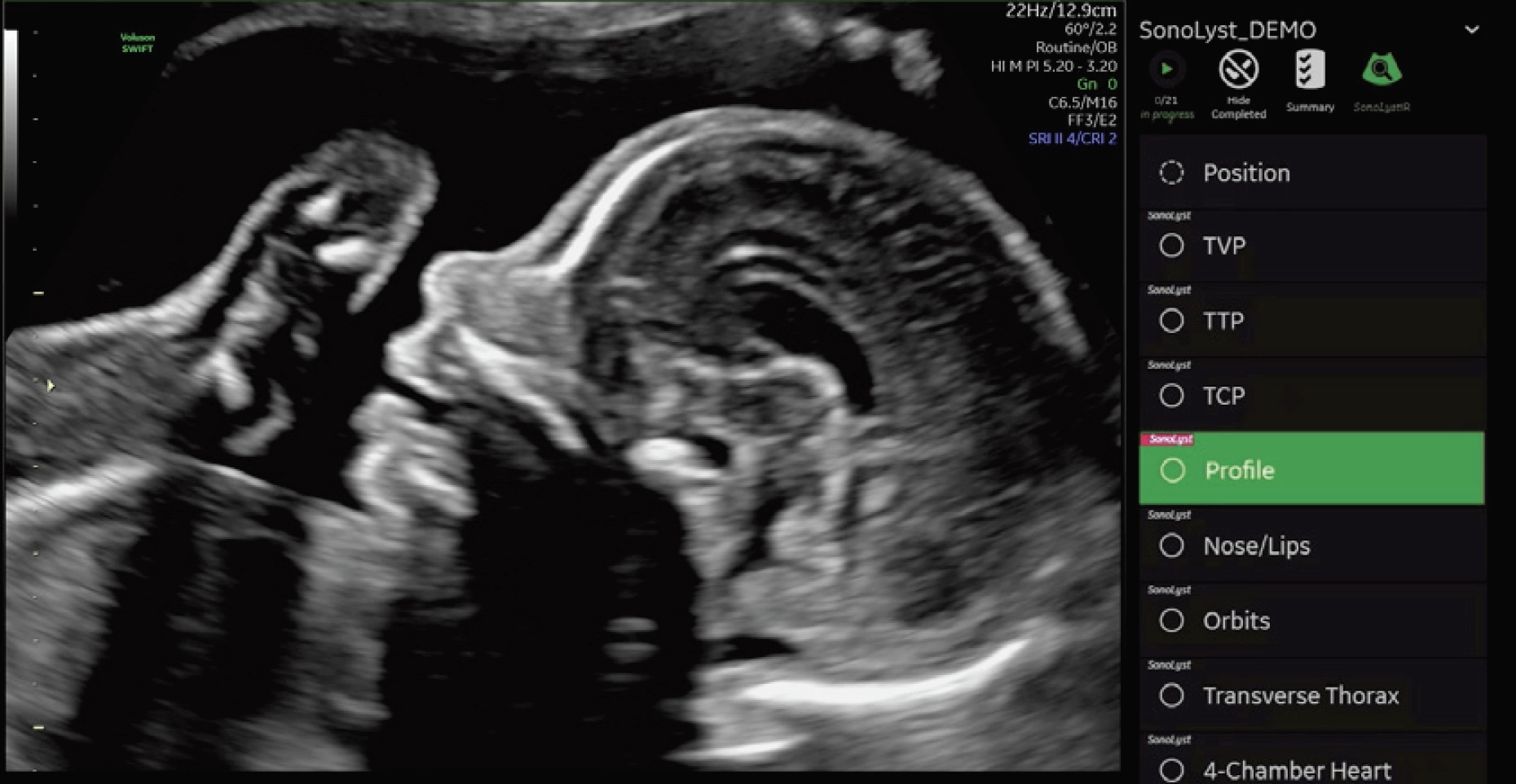 Product Media Carousel Image