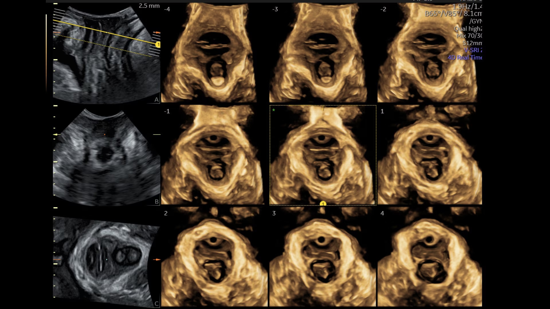 Product Media Carousel Image