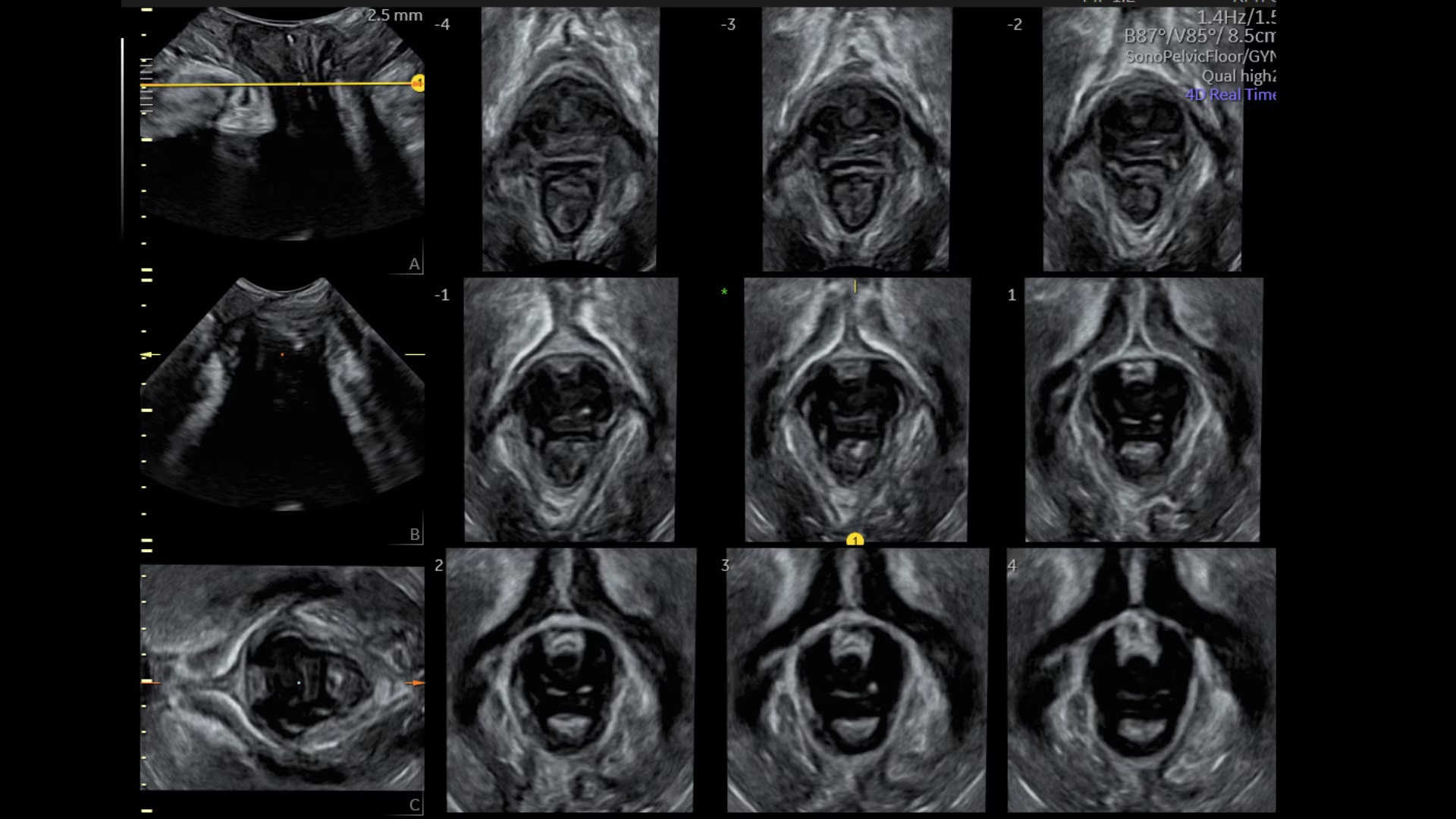 Product Media Carousel Image