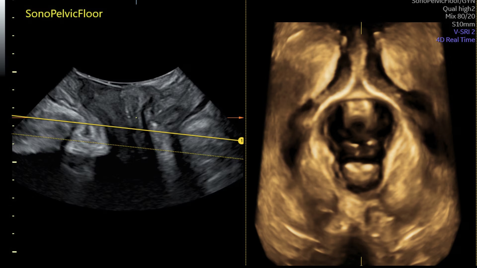 Product Media Carousel Image