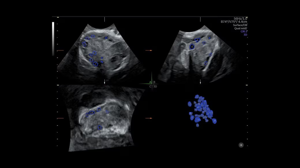 Product Media Carousel Image