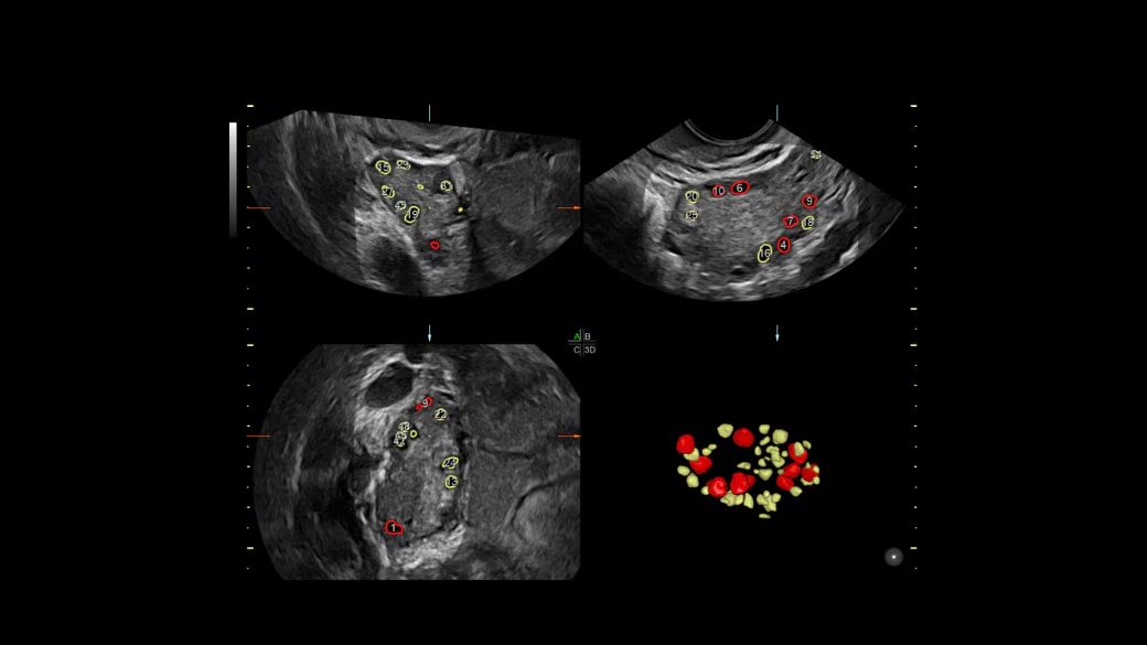 Product Media Carousel Image