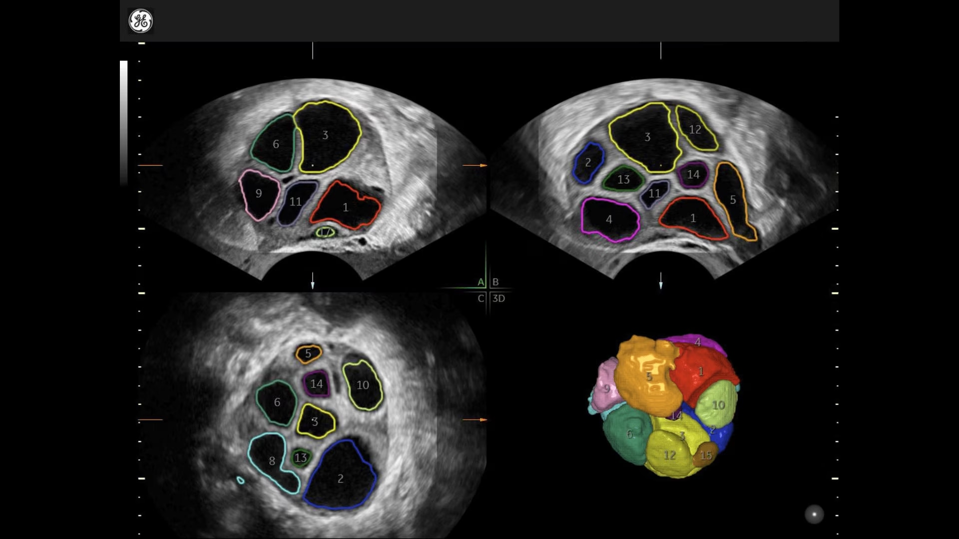 Product Media Carousel Image