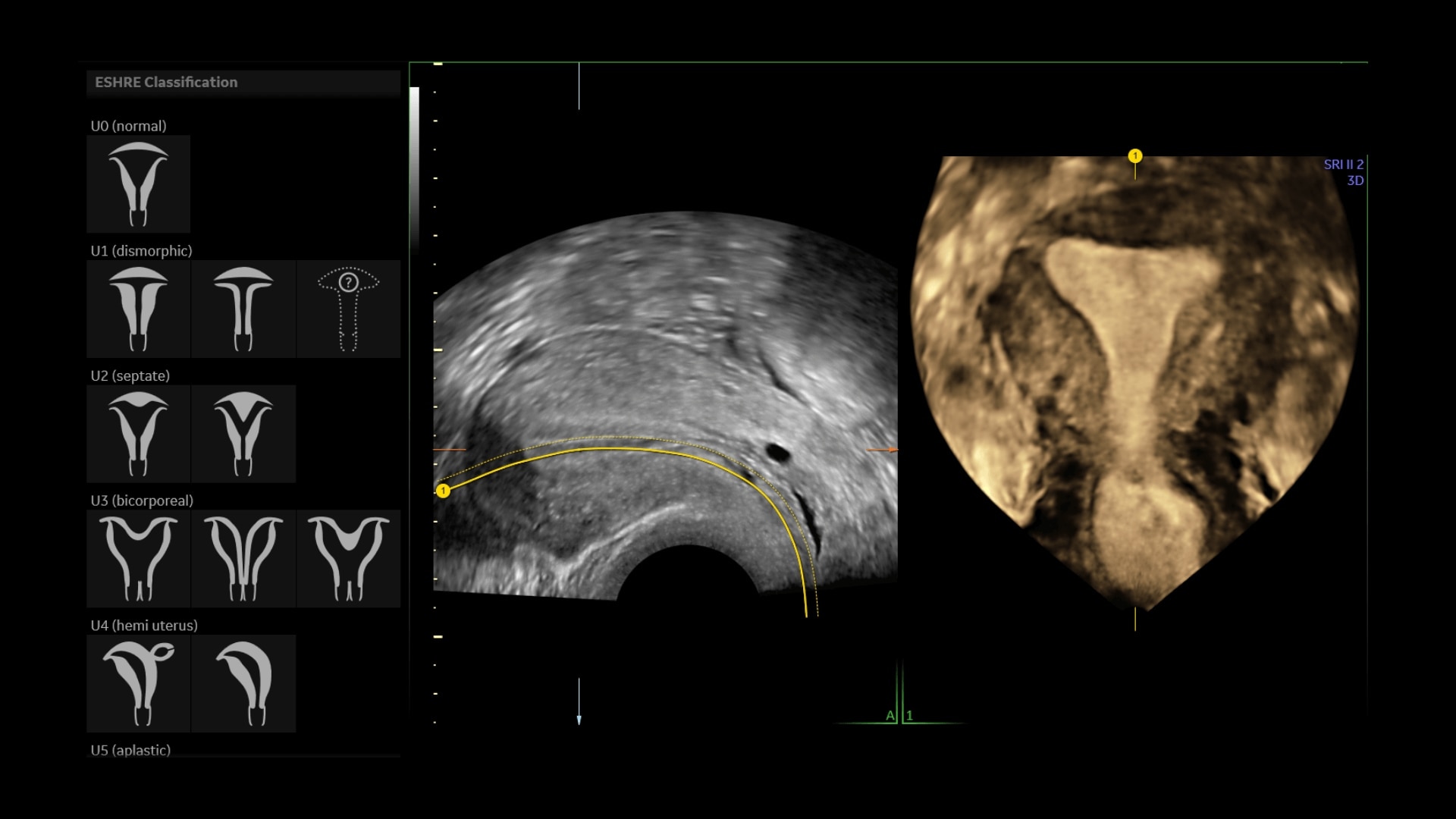 Product Media Carousel Image