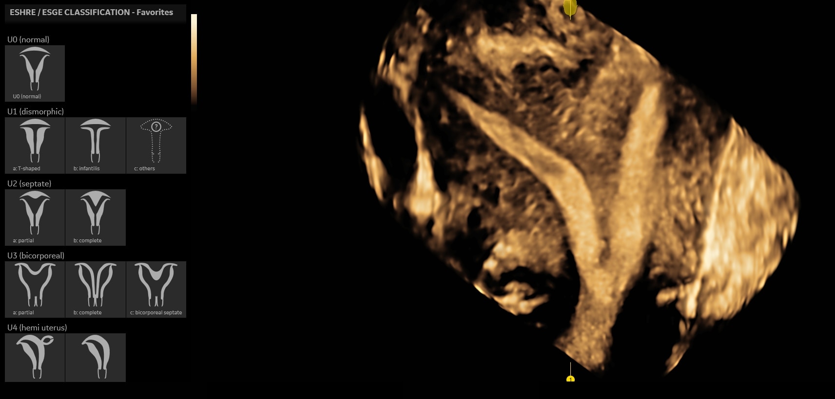 Product Media Carousel Image