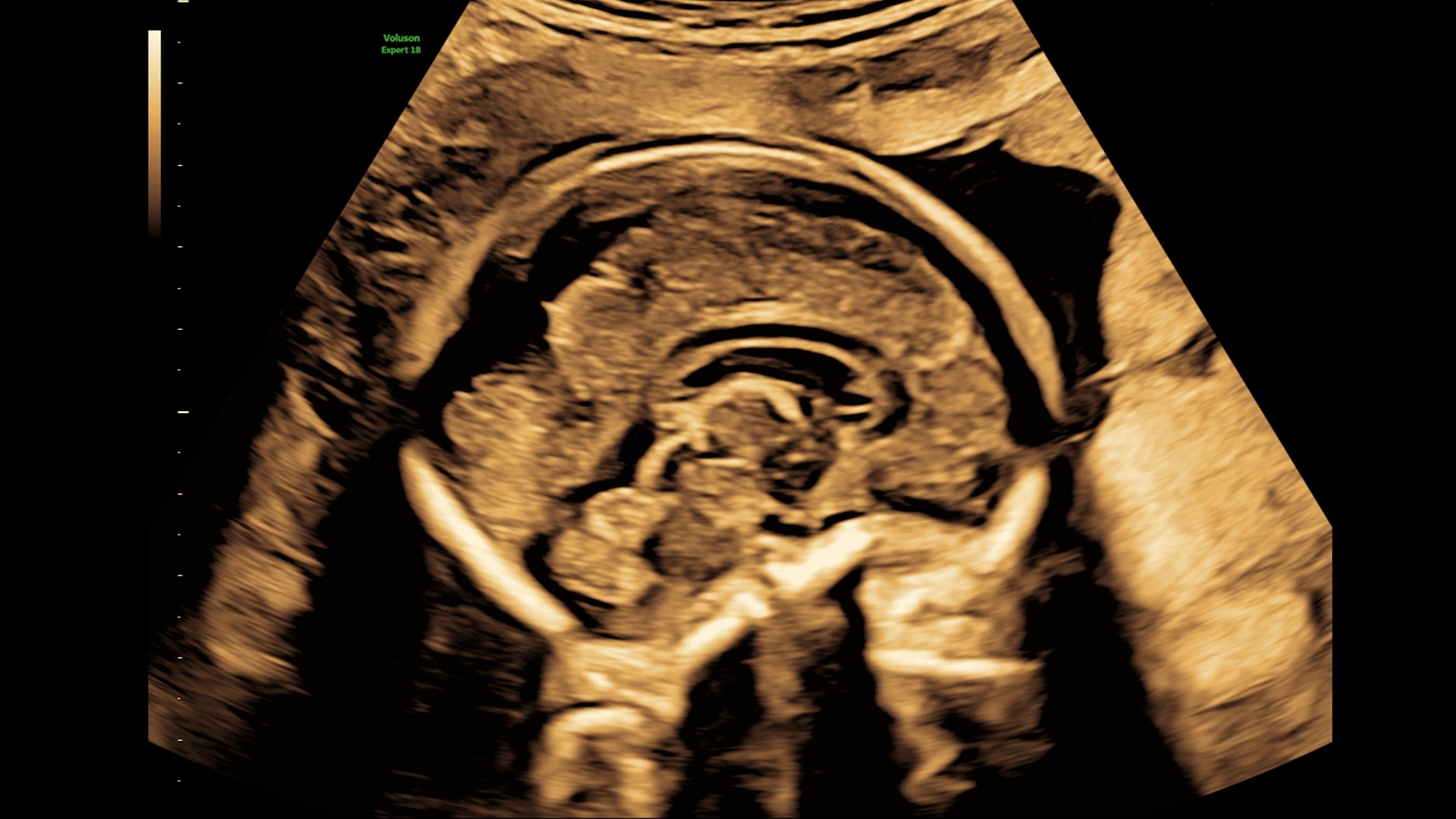 Product Media Carousel Image