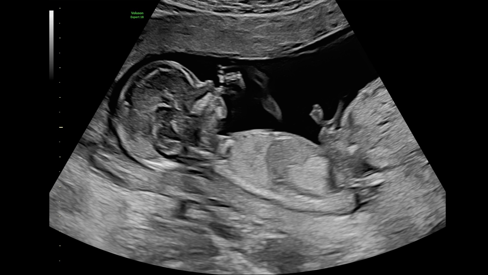 Product Media Carousel Image