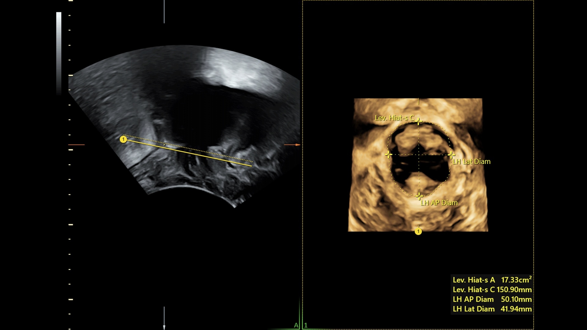 Product Media Carousel Image