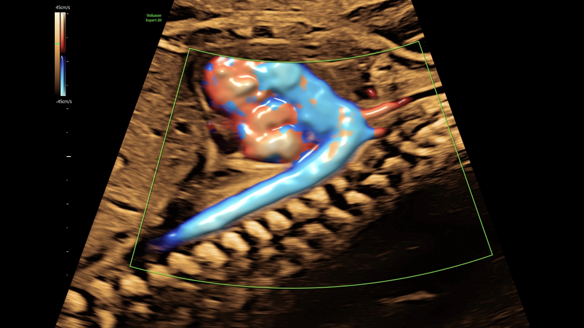 Product Media Carousel Image