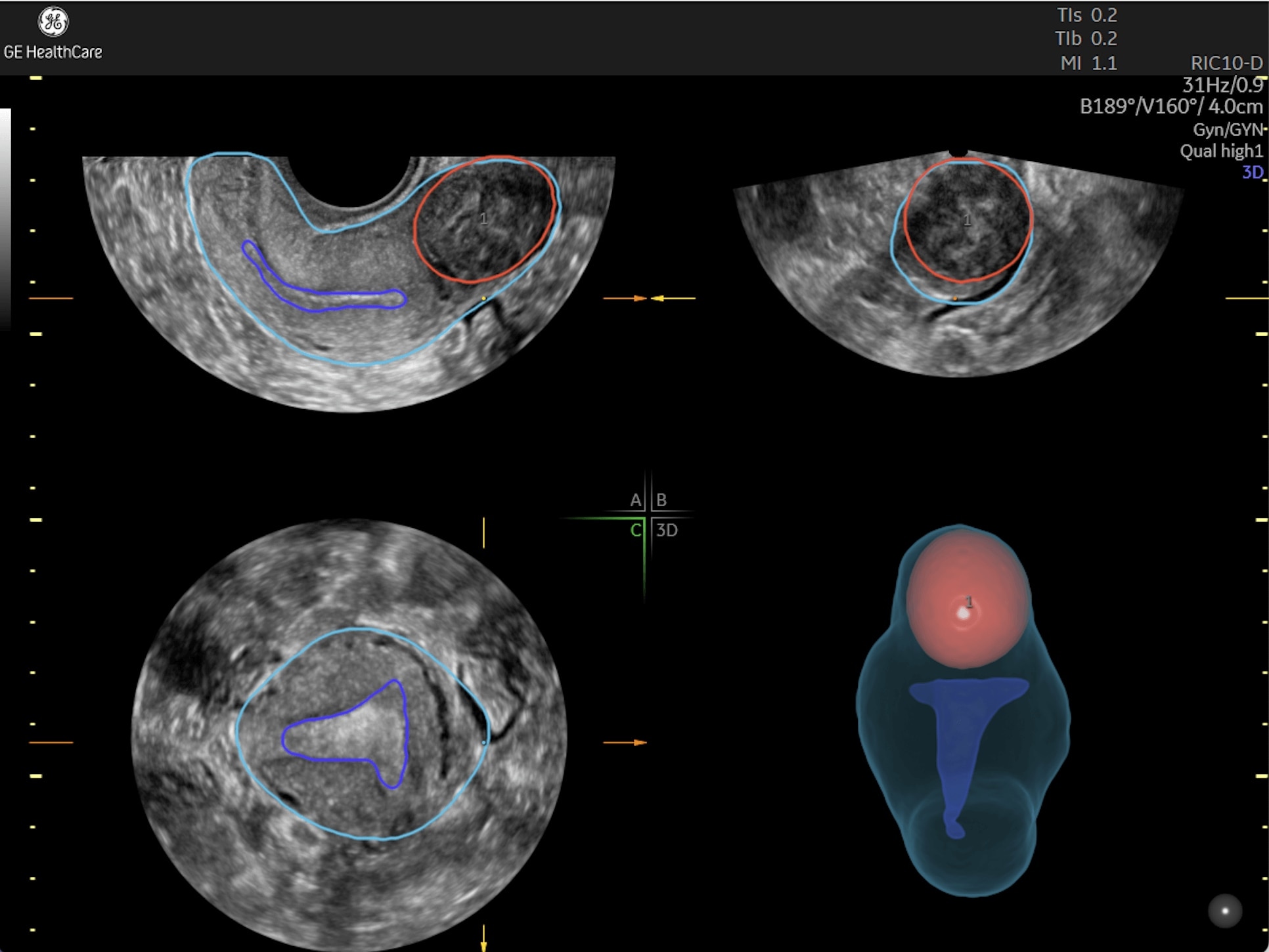 Product Media Carousel Image