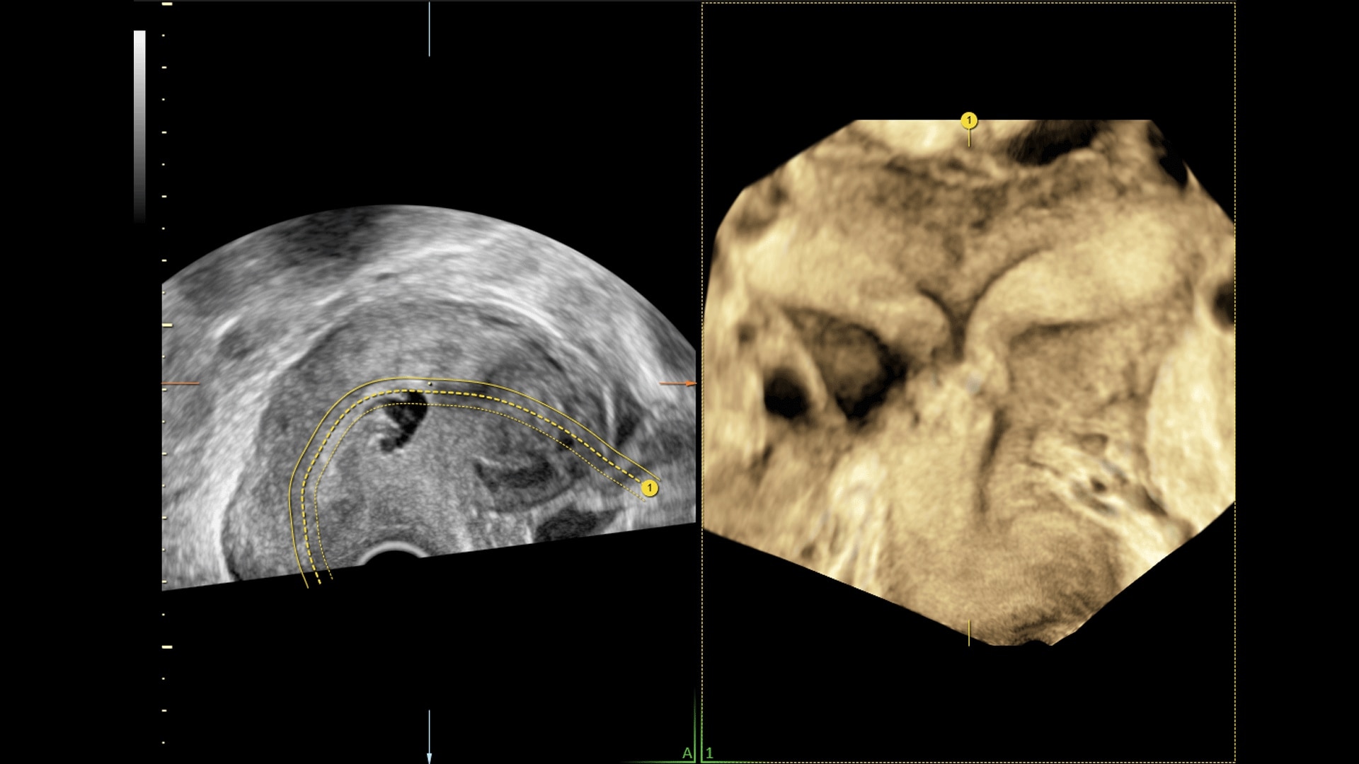 Product Media Carousel Image