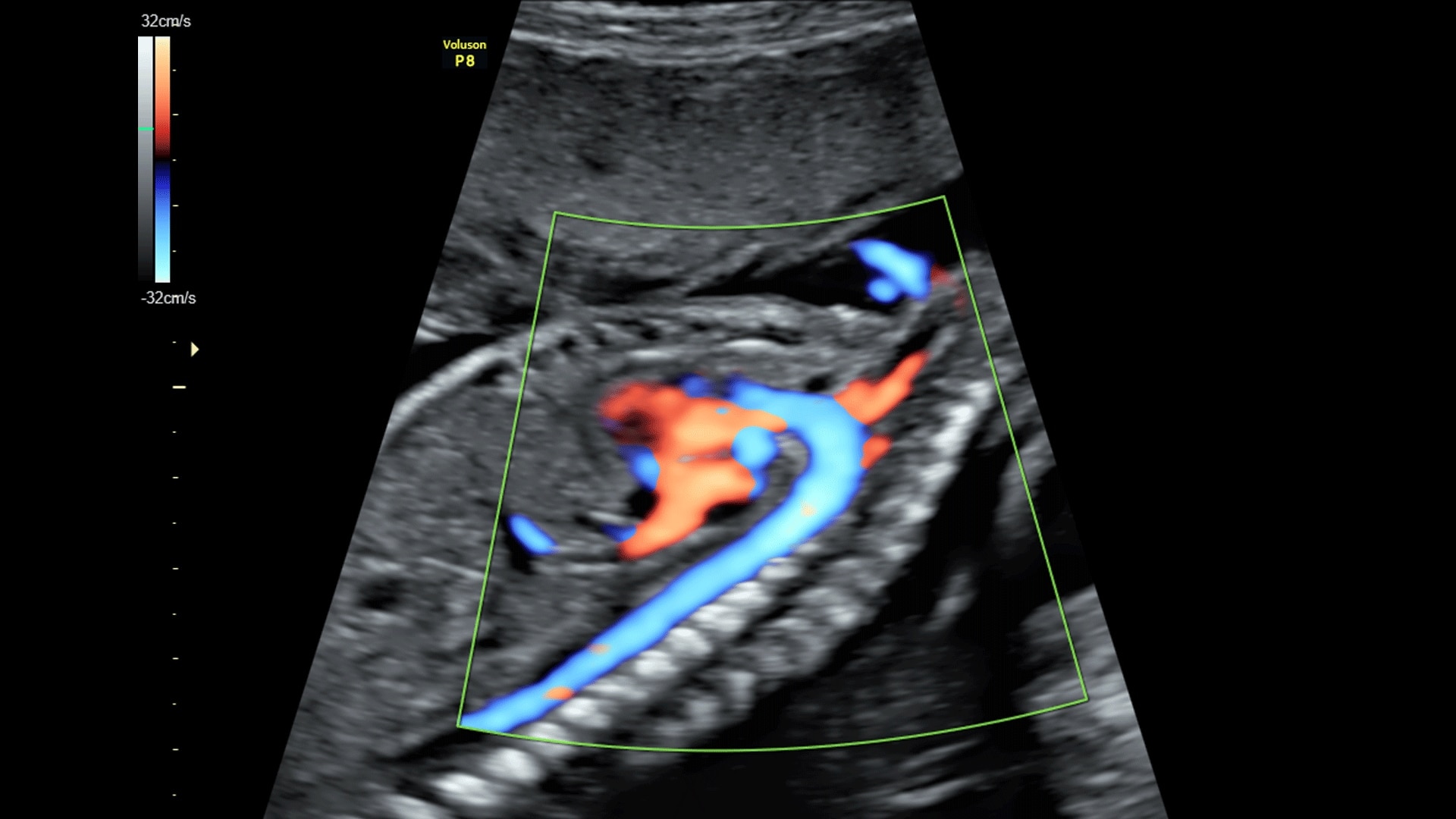 Product Media Carousel Image