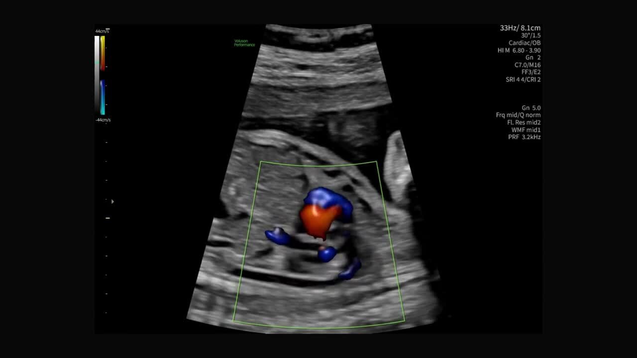 Product Media Carousel Image