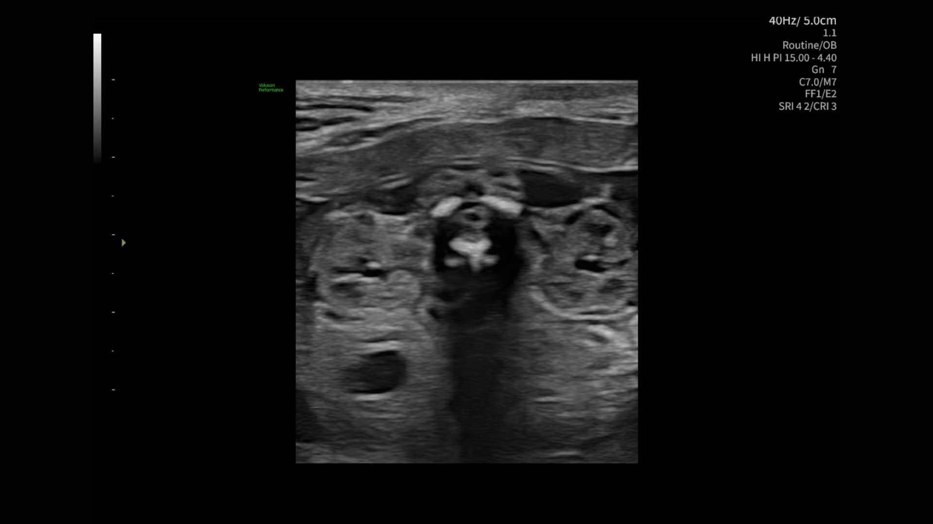 Product Media Carousel Image