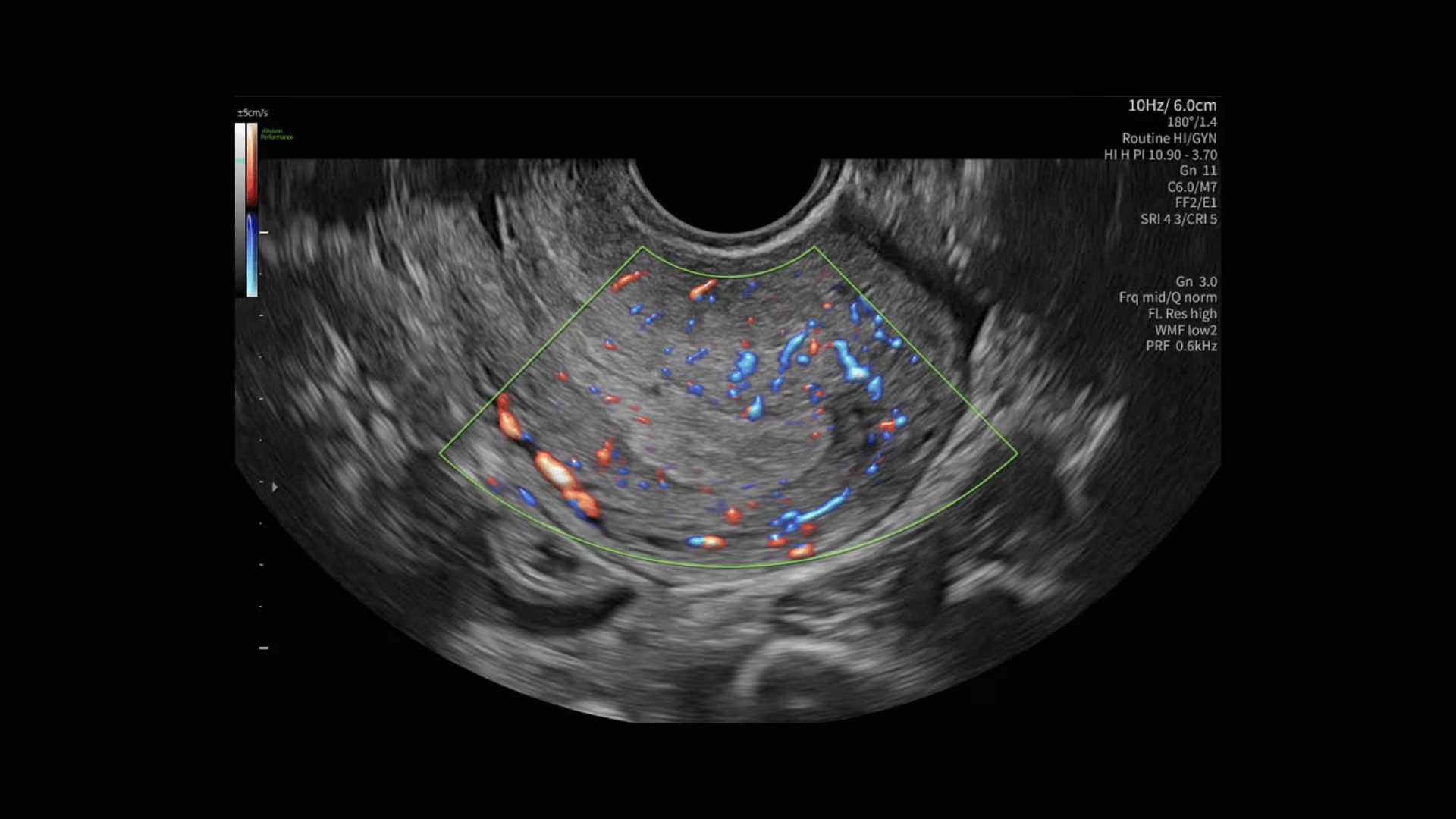 Product Media Carousel Image