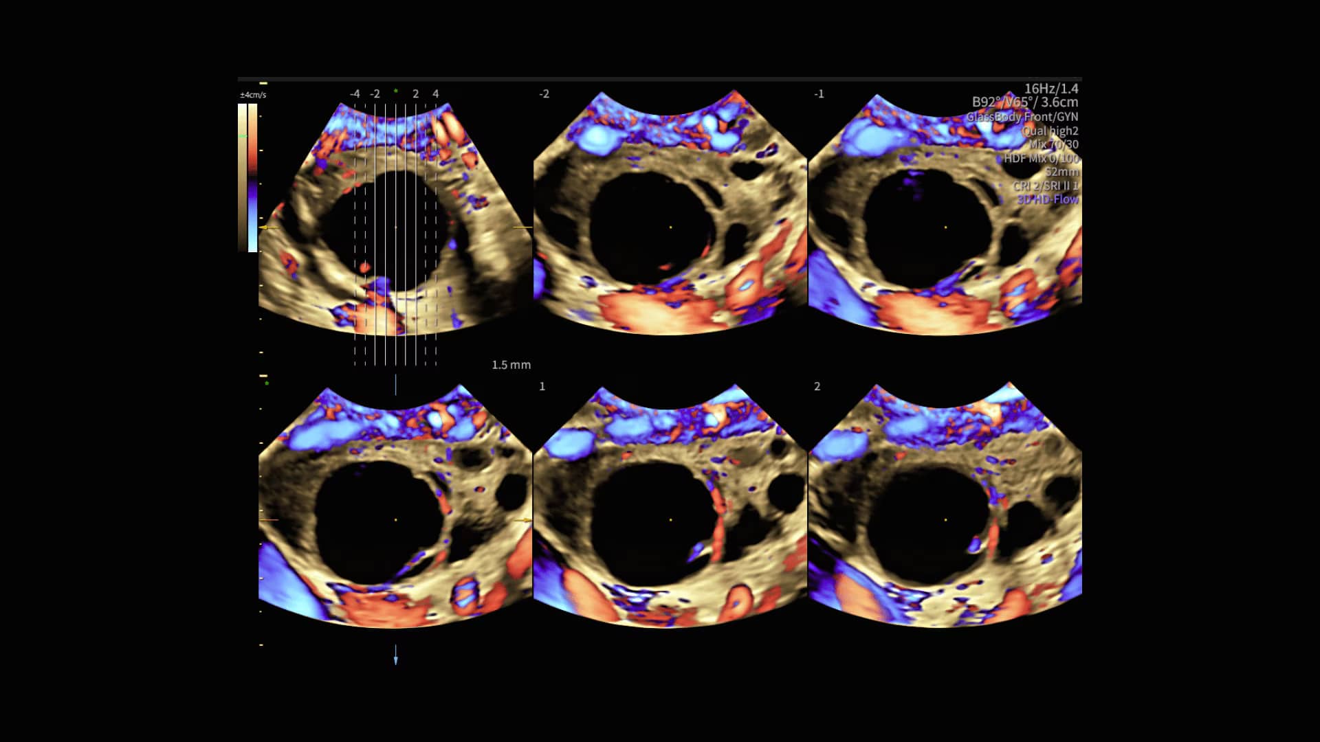 Product Media Carousel Image