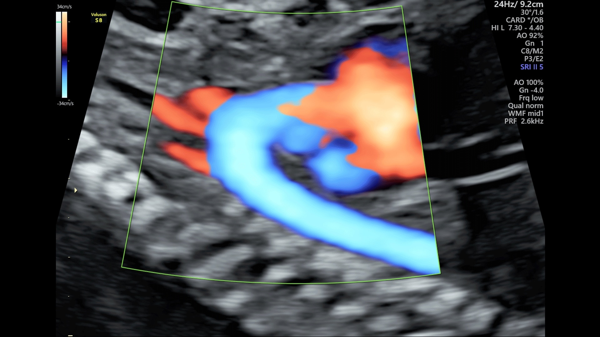 Product Media Carousel Image