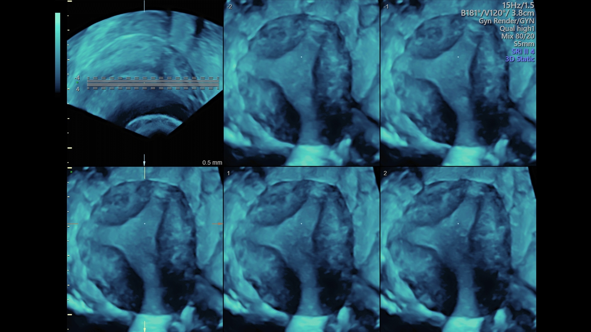 Product Media Carousel Image