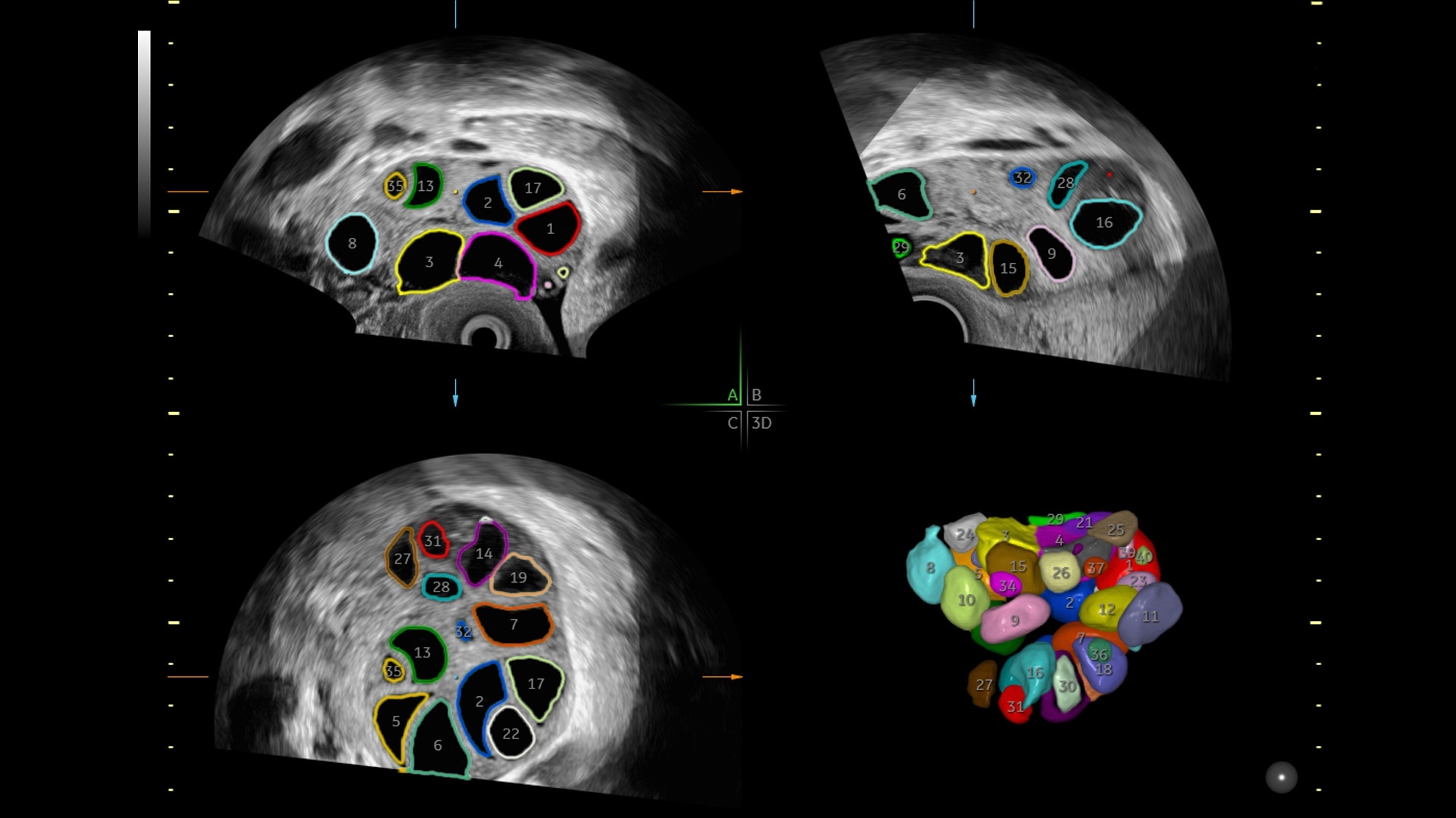 Product Media Carousel Image
