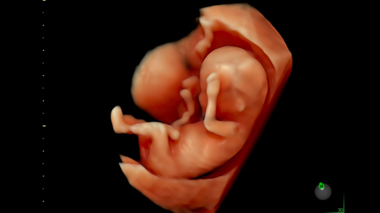 Product Media Carousel Image