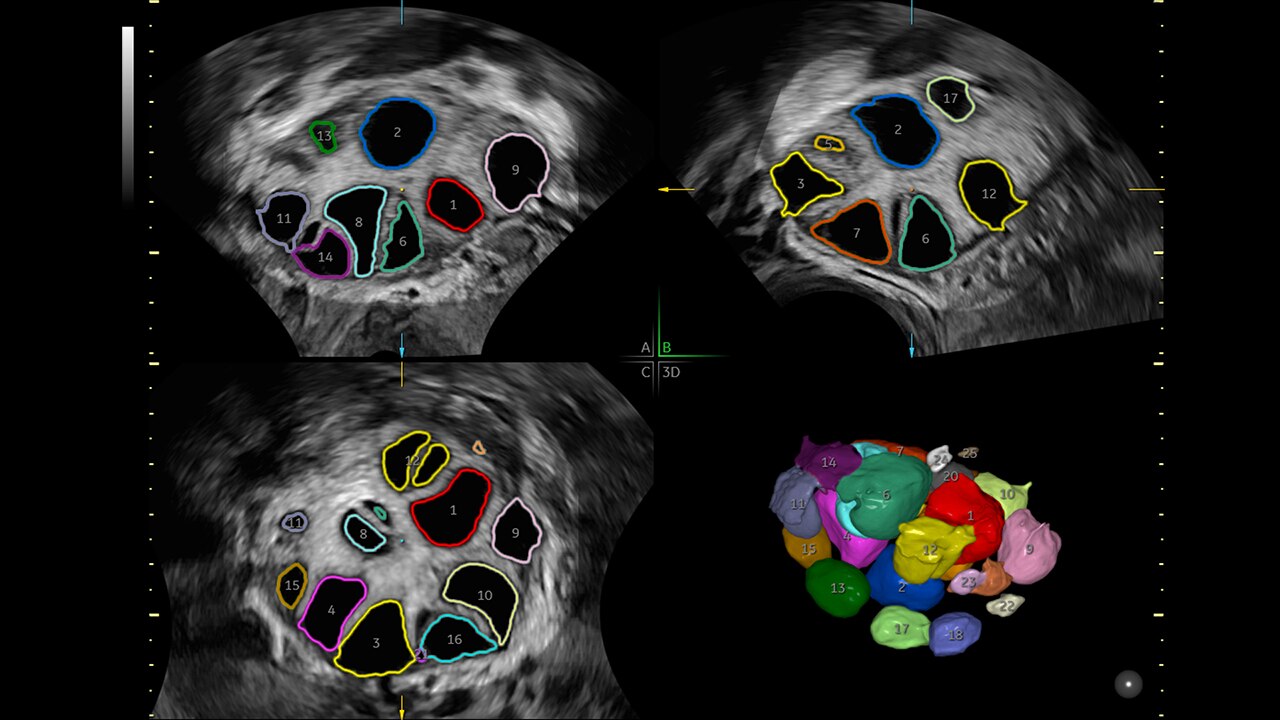 Product Media Carousel Image