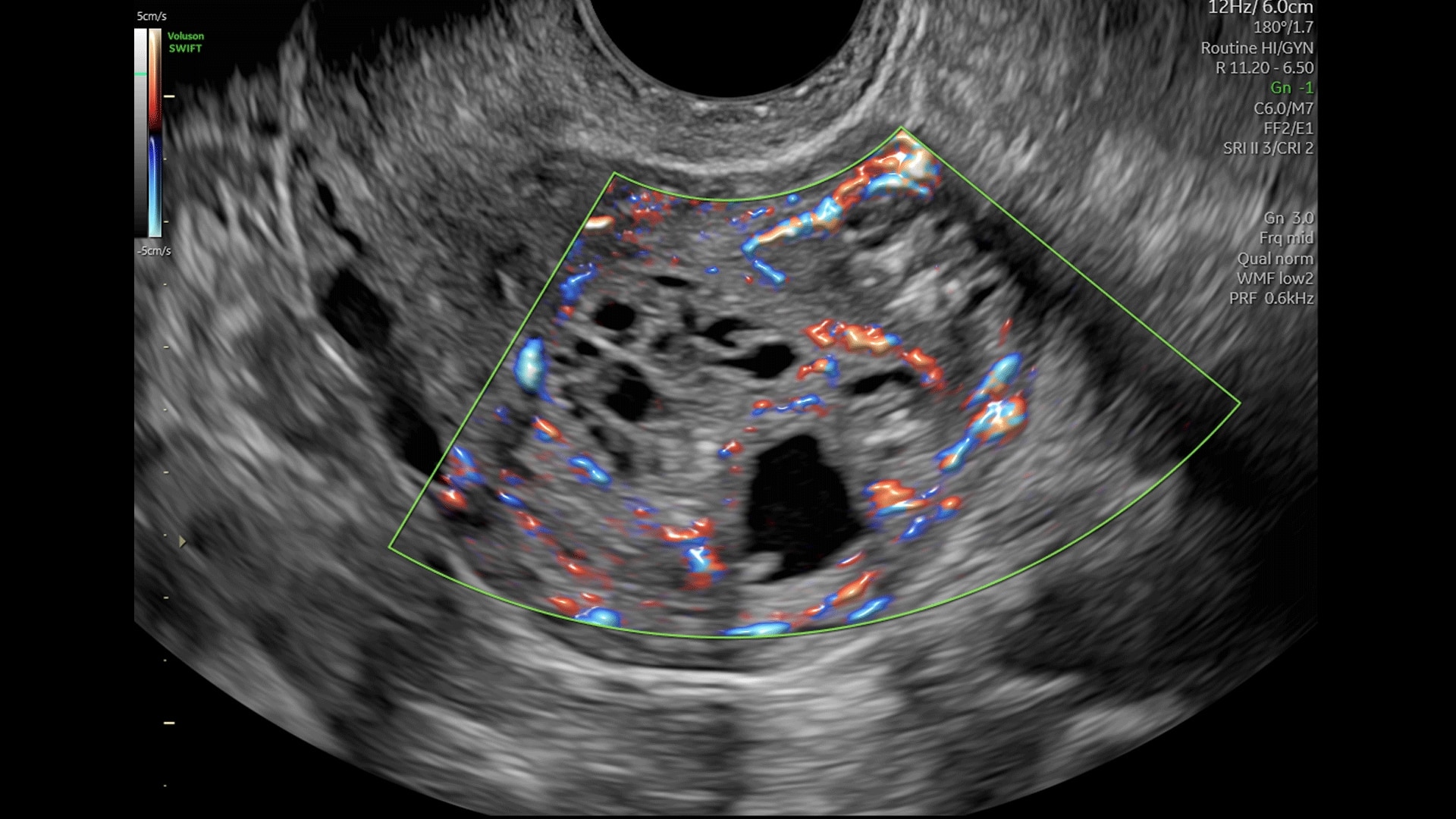 Product Media Carousel Image
