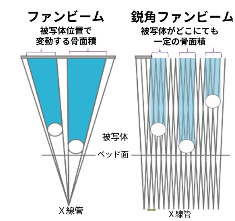 PRODIGY シリーズ | 骨密度測定装置 | 病院やクリニックの導入検討に