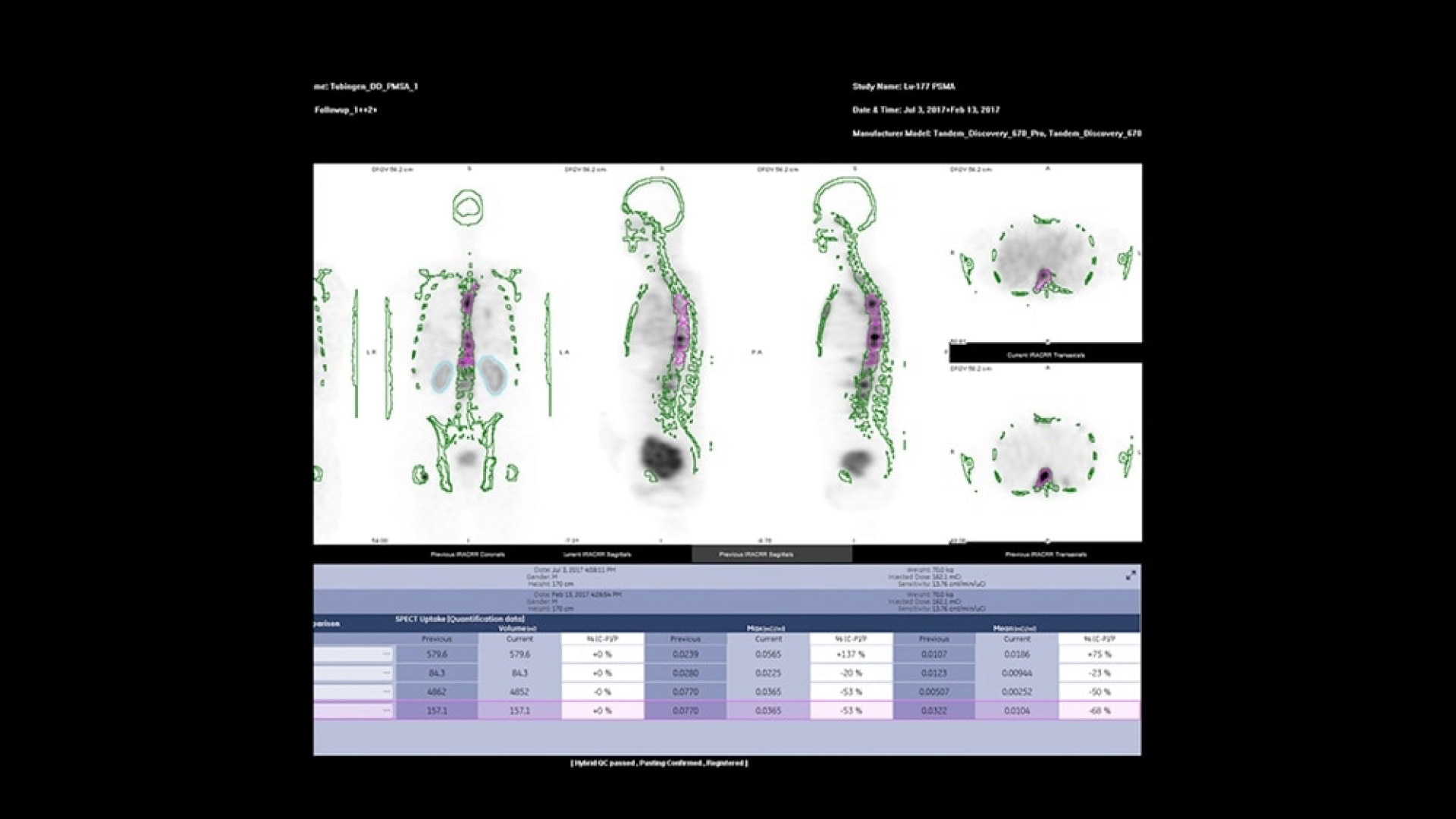 Product Media Carousel Image