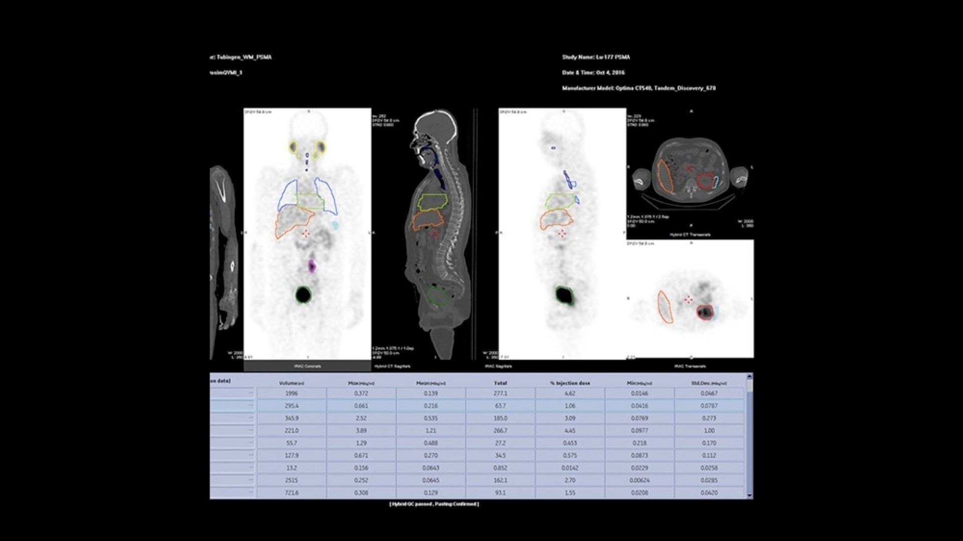 Product Media Carousel Image