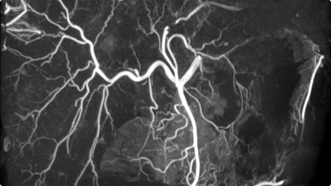 Product Media Carousel Image