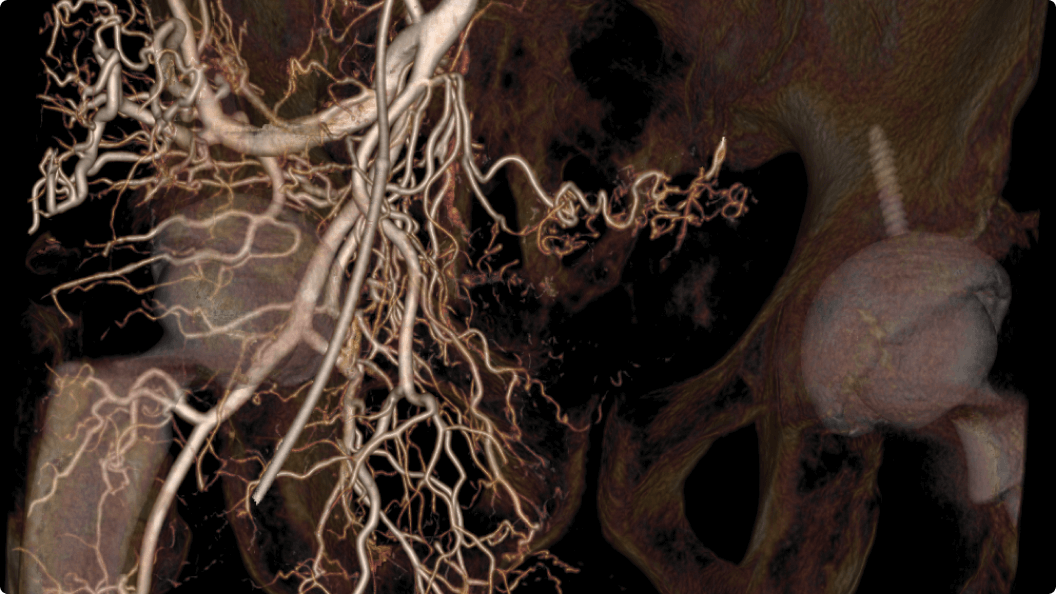 Product Media Carousel Image