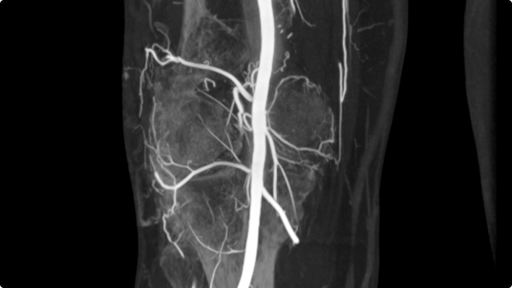 Product Media Carousel Image