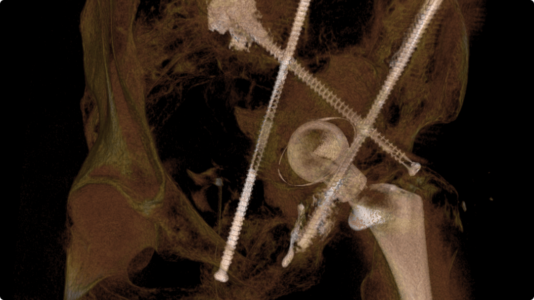 Product Media Carousel Image