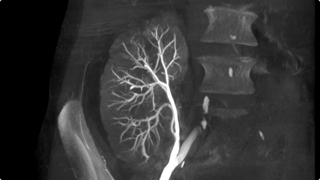 Product Media Carousel Image