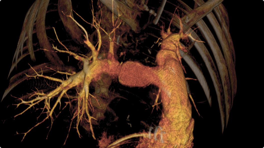 Product Media Carousel Image