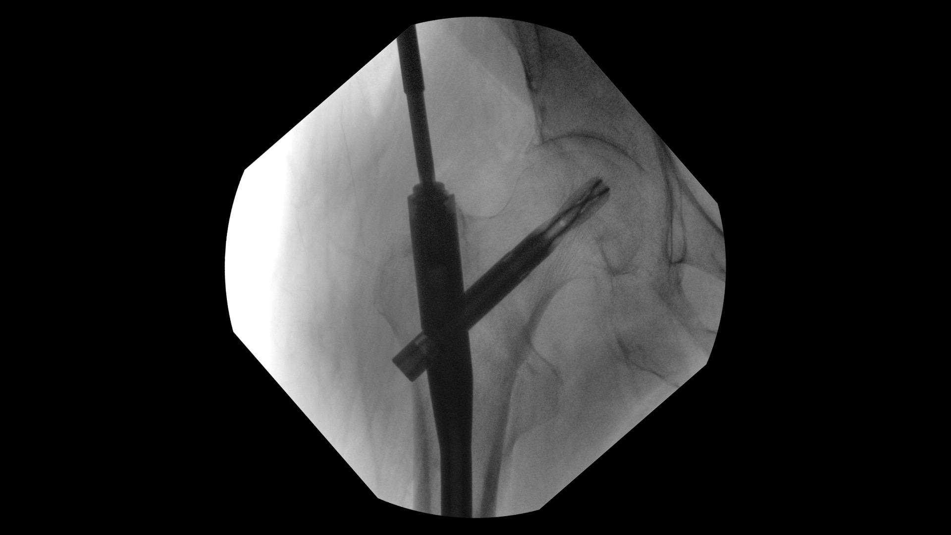 Product Media Carousel Image