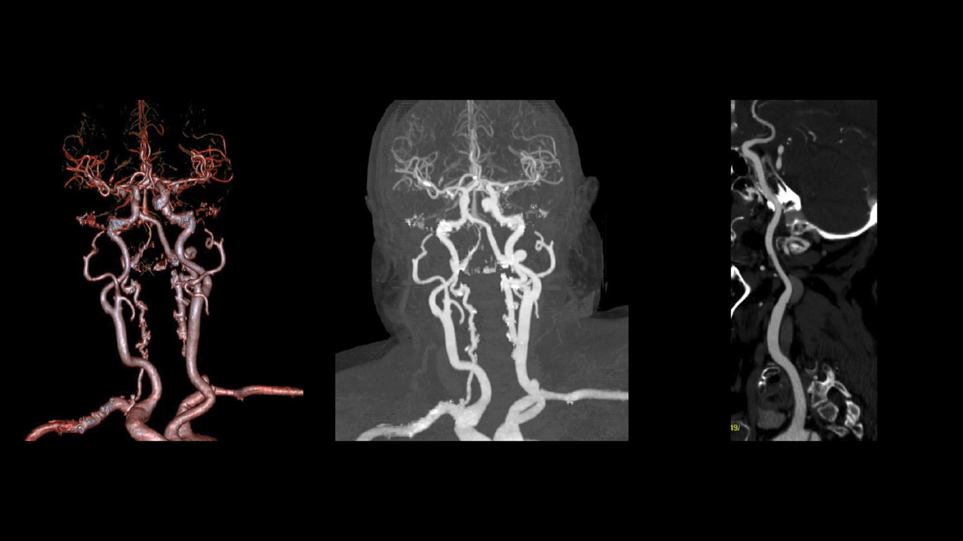 Product Media Carousel Image