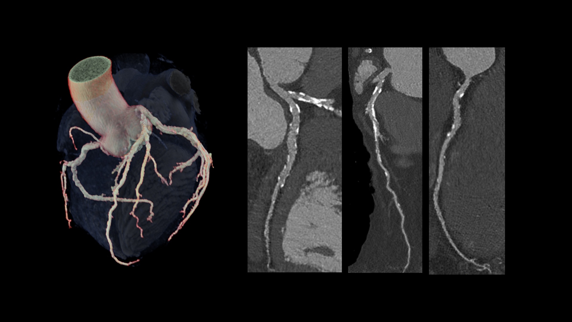 Product Media Carousel Image