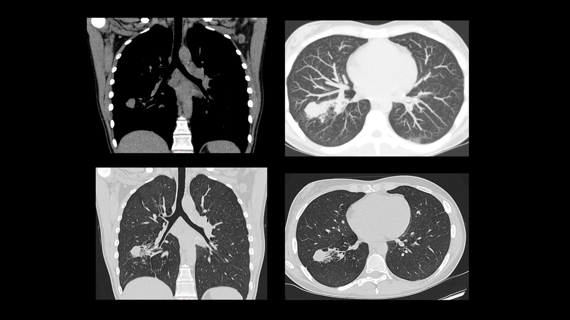 Product Media Carousel Image