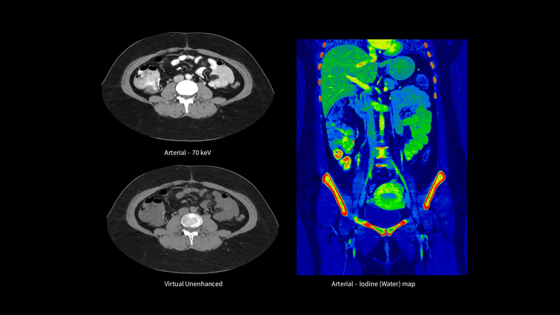 Product Media Carousel Image