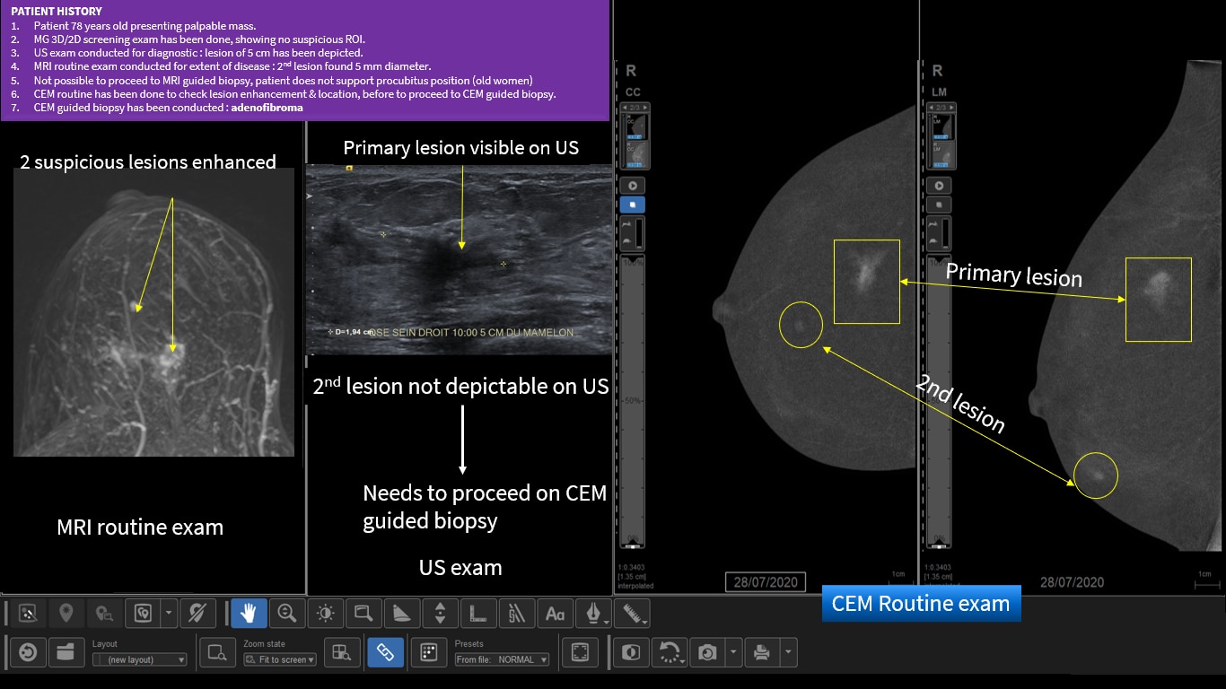 Product Media Carousel Image