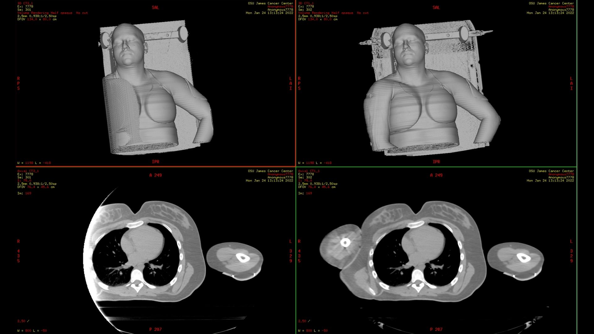 Product Media Carousel Image