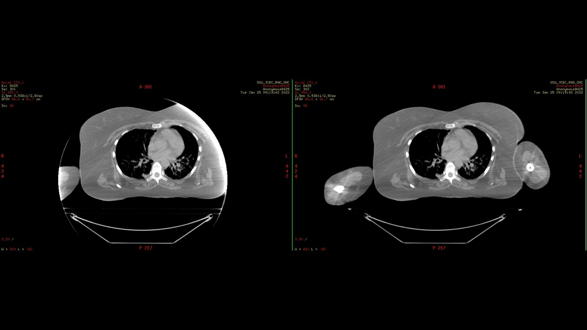 Product Media Carousel Image