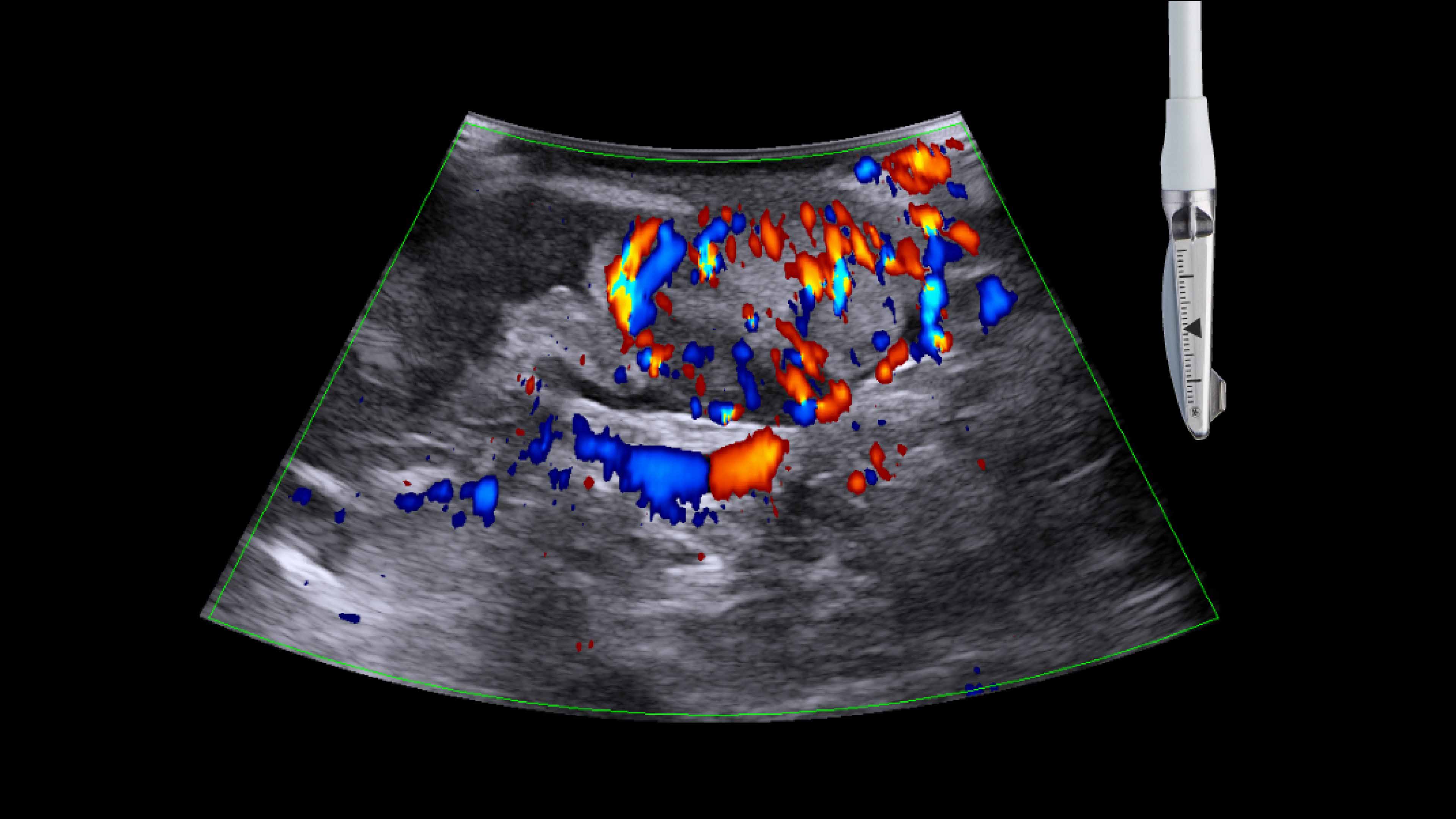 Product Media Carousel Image