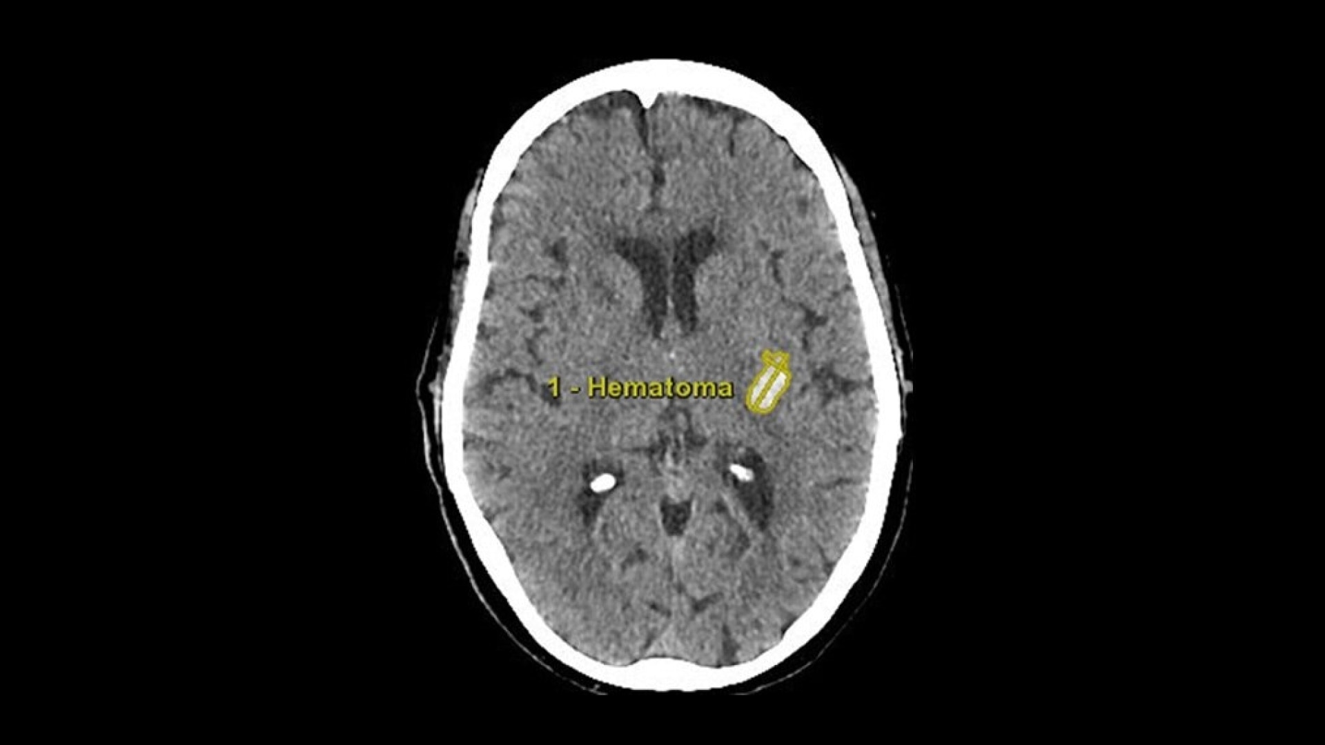 Product Media Carousel Image