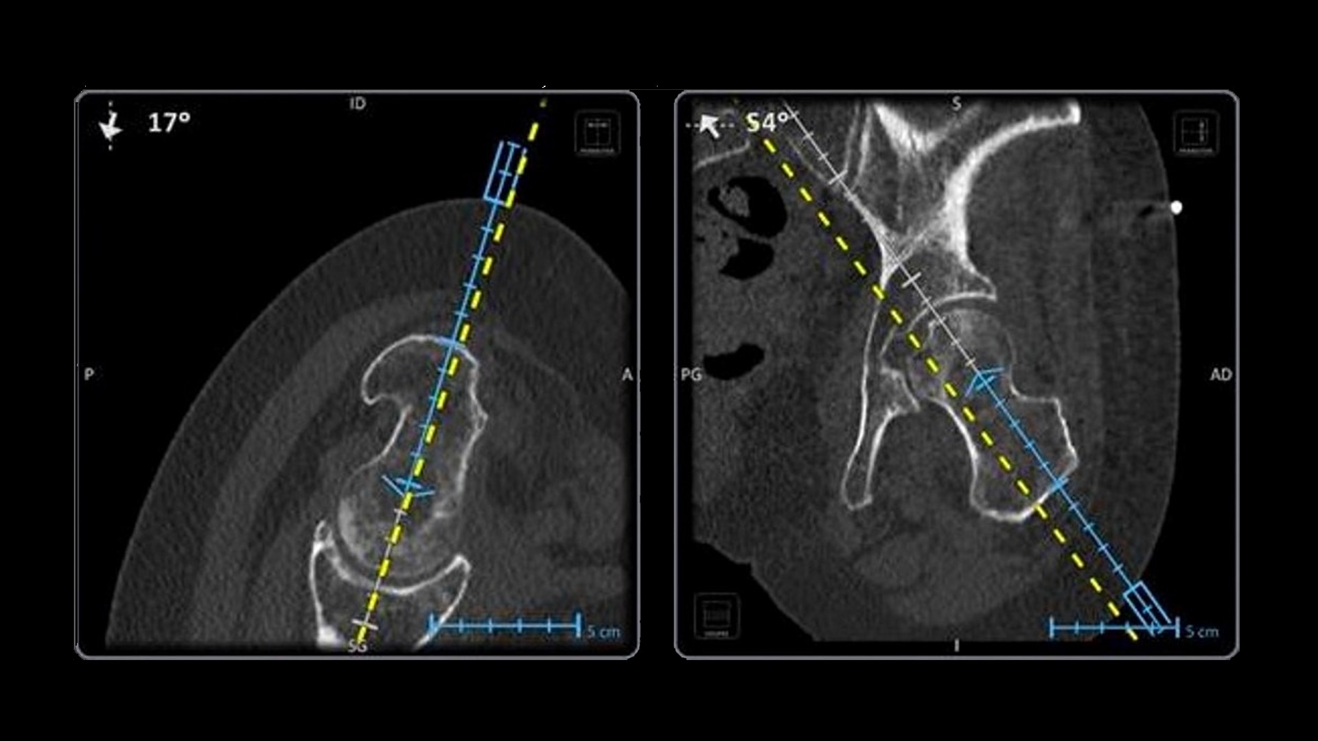 Product Media Carousel Image
